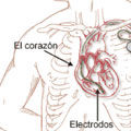 Cardio Electrofisiología